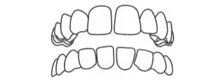 Gap Teeth