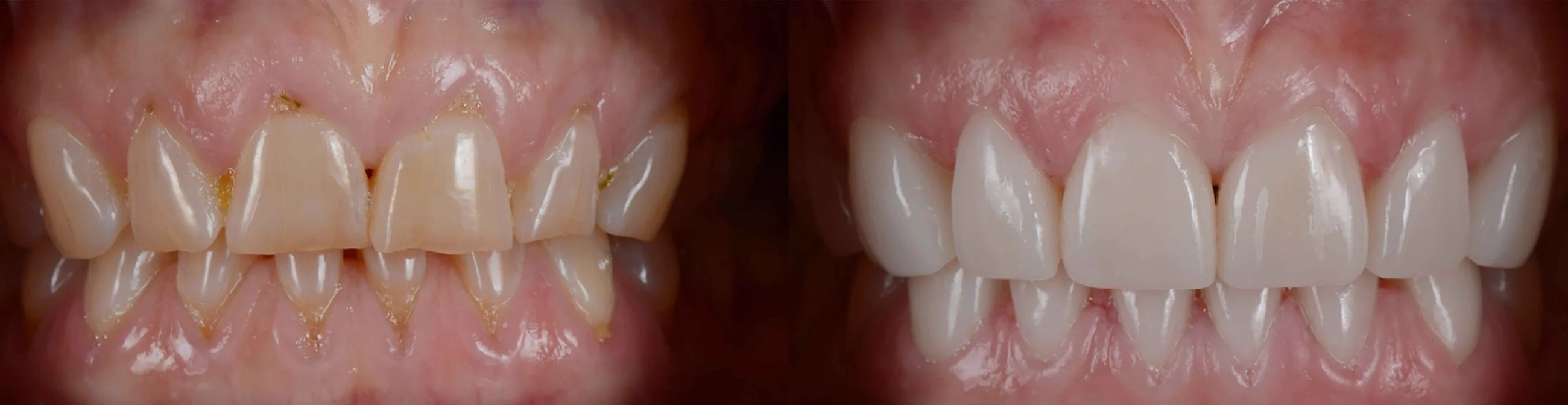 Dental artistry