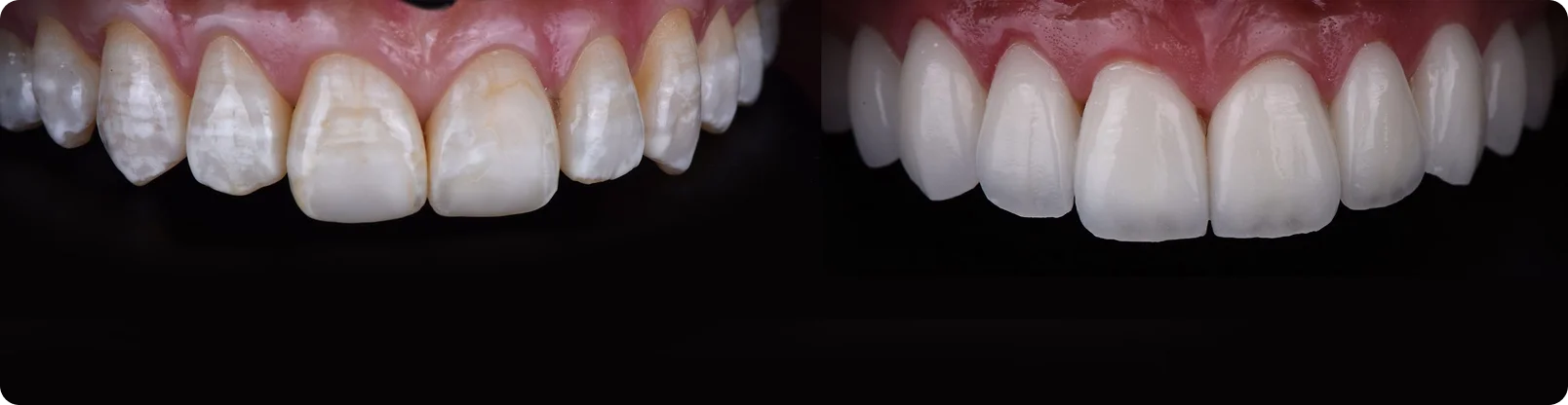 Dental artistry