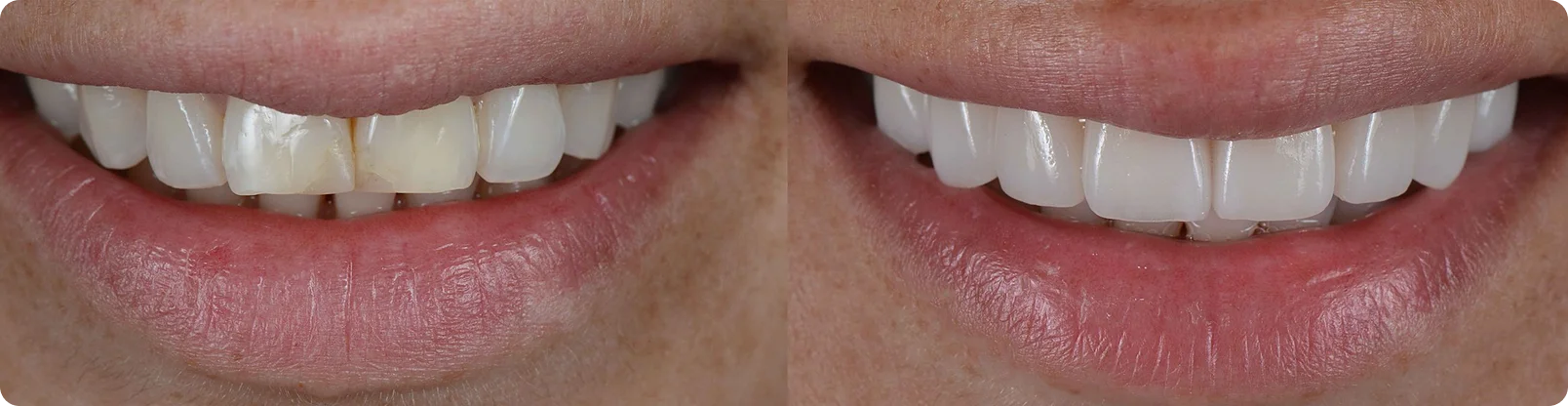 Dental artistry