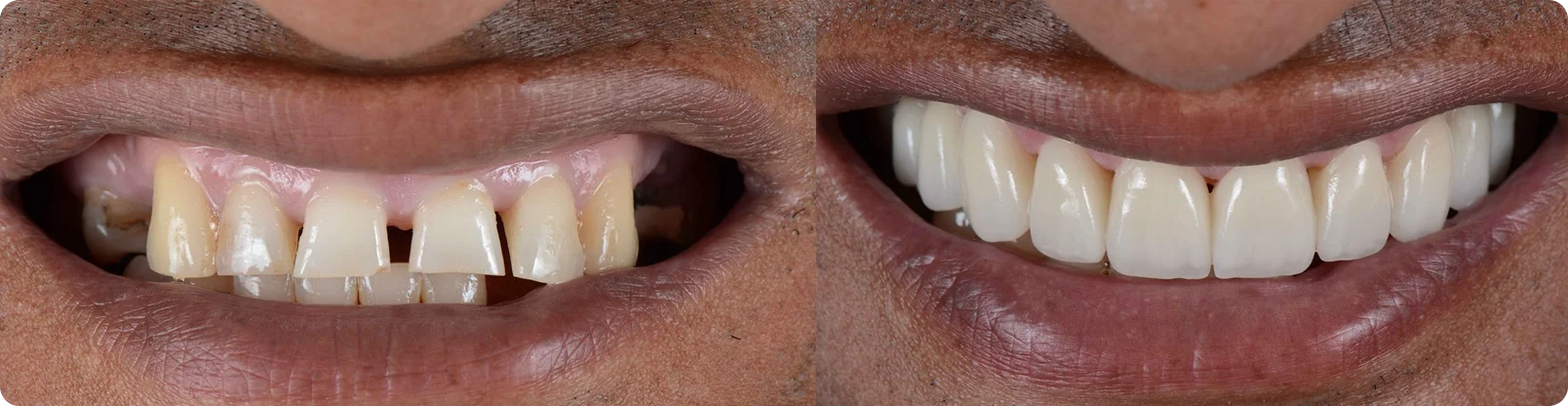 Dental artistry