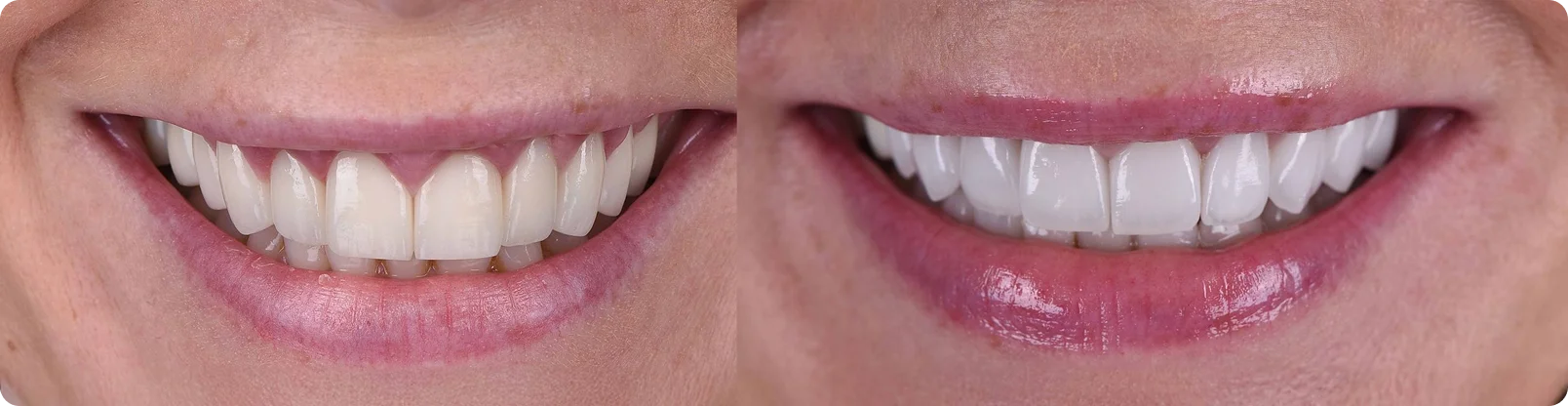Dental artistry