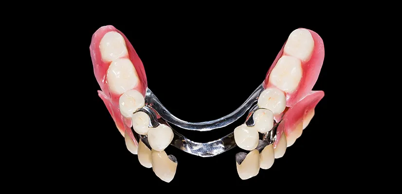 Partial Dentures