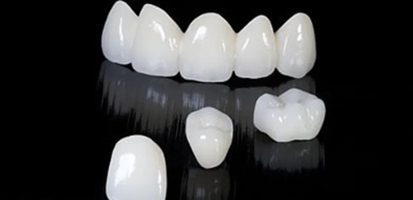 Zirconia Crowns