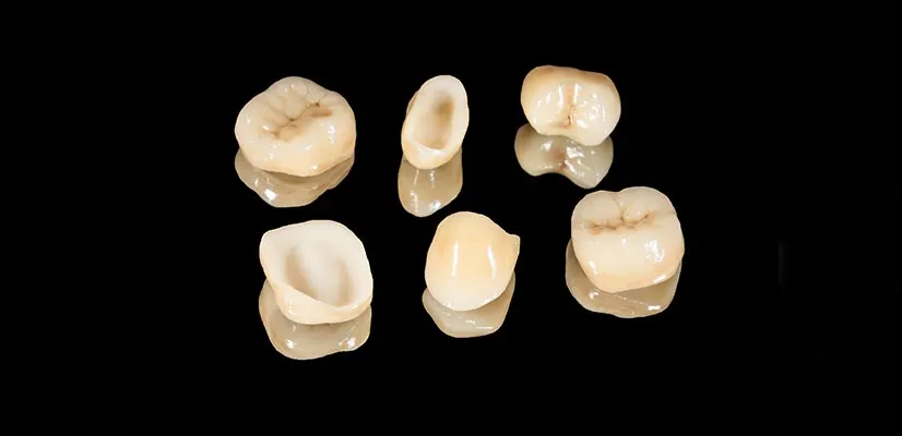 Porcelain Crowns