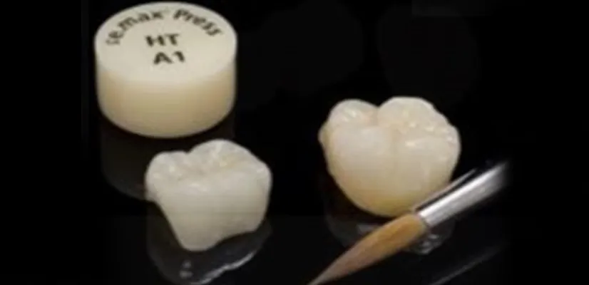 E-Max Crowns