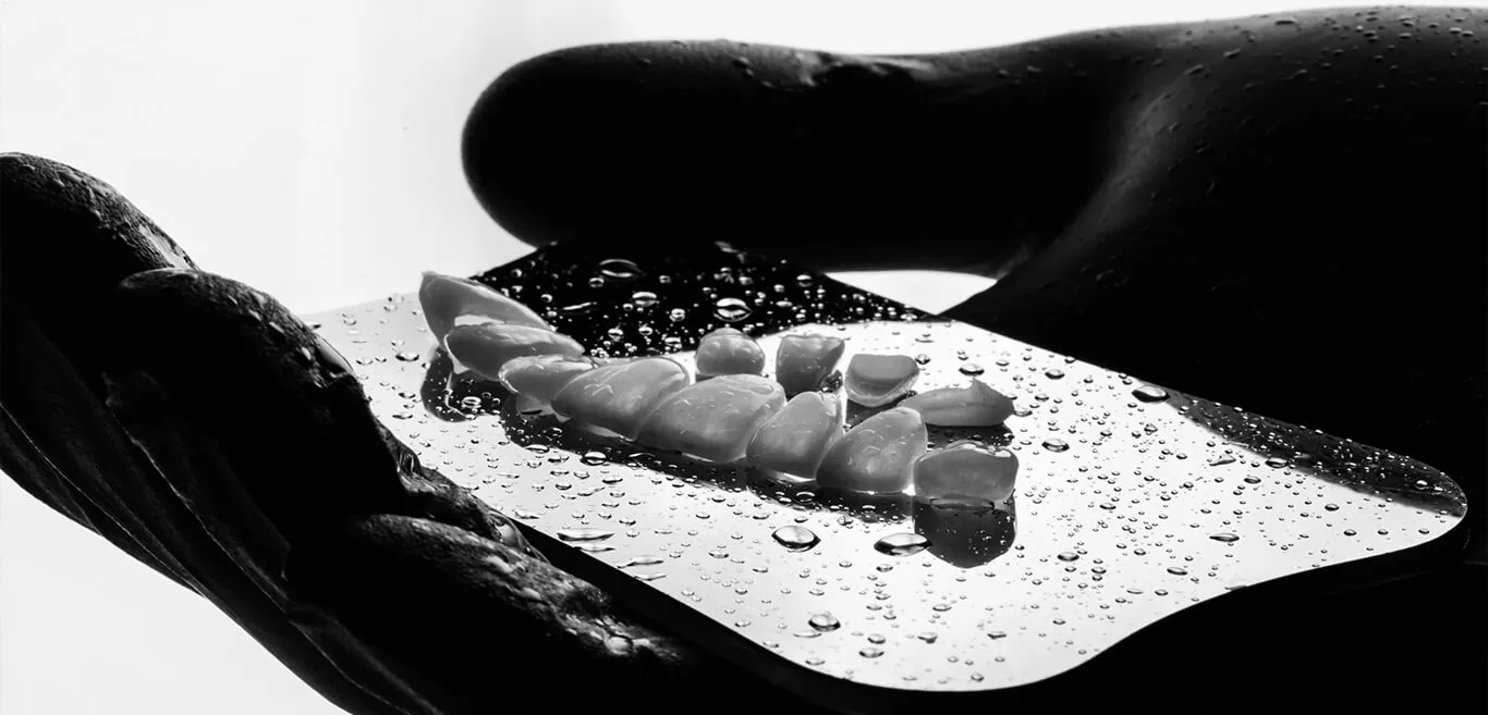 Veneers benefits